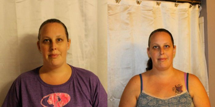 Before and after LOral Revitalift